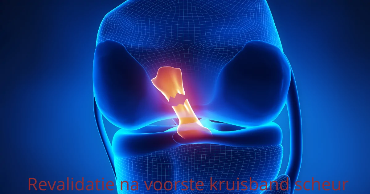 Revalidatie na een voorste-kruisbandoperatie: de fases en wanneer je weer mag sporten