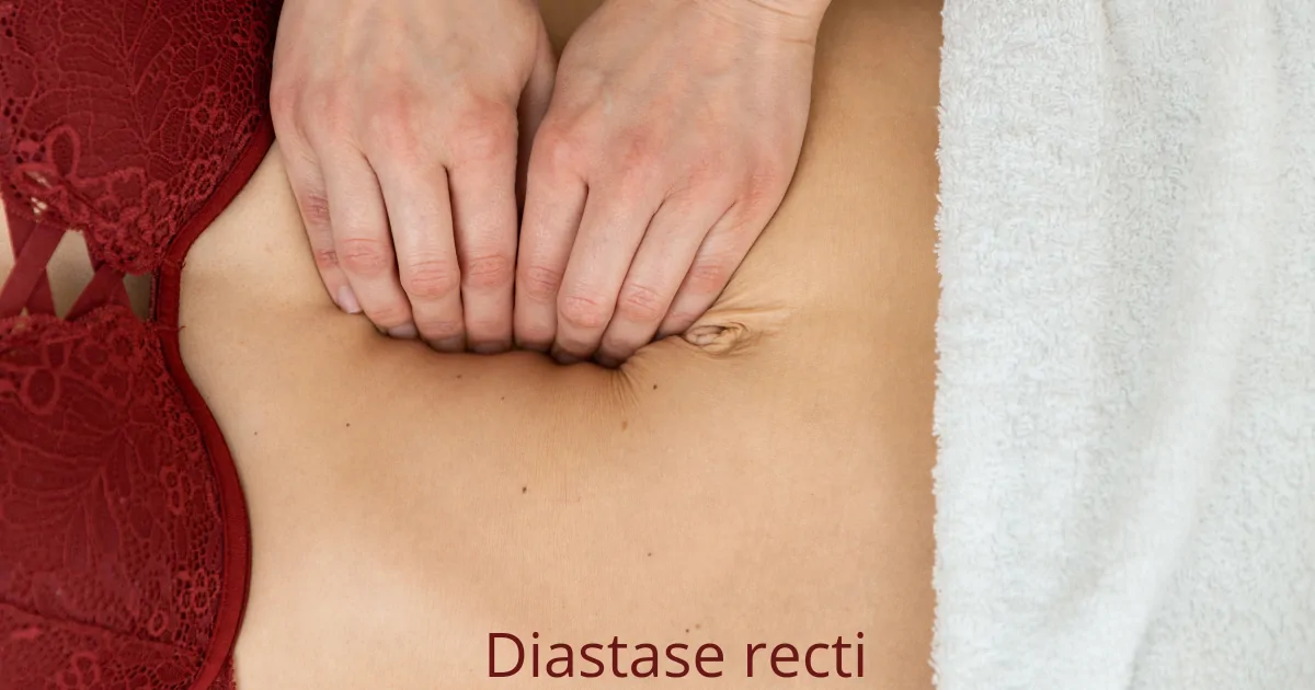 Diastase Recti: Complete Gids voor Herstel Na Zwangerschap