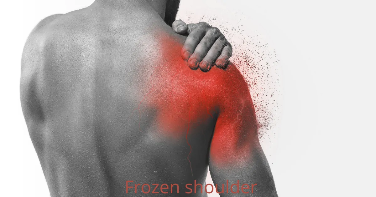 Frozen Shoulder: Symptomen, Behandeling en Herstel