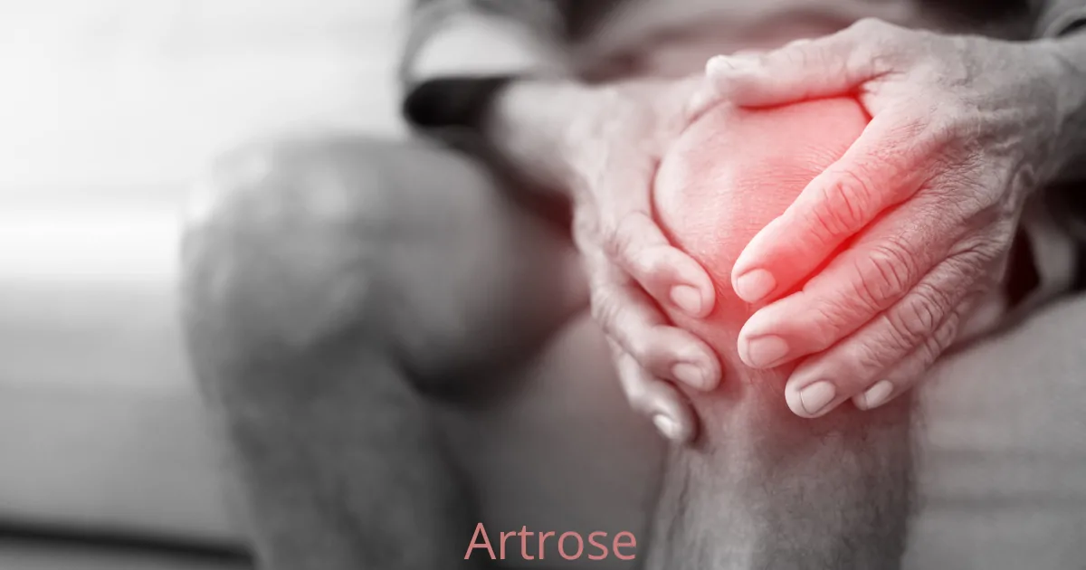 Artrose: Hoe kinesitherapie kan helpen