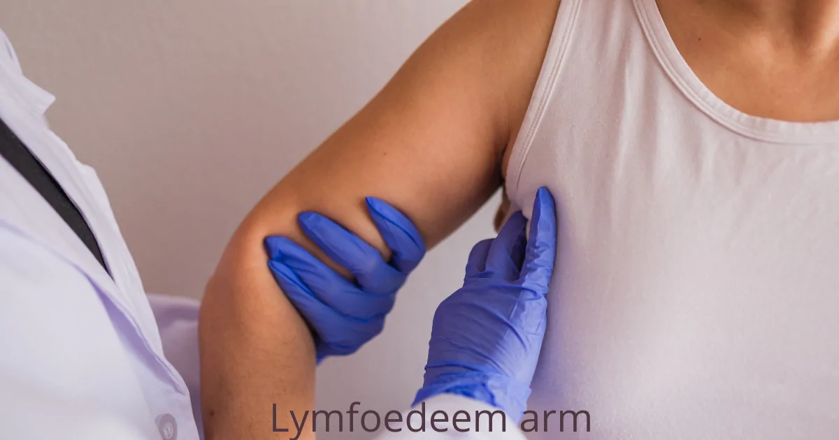 Lymfoedeem arm na borstkanker: behandeling en preventie